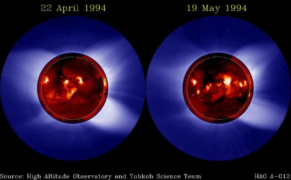 April 22, 1994: Two coronal images